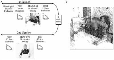 Mirror Box Training in Hemiplegic Stroke Patients Affects Body Representation